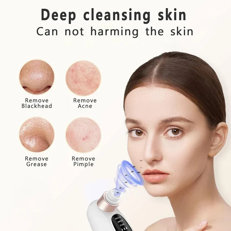 USB Rechargeable Blackhead Remover Pore Vacuum