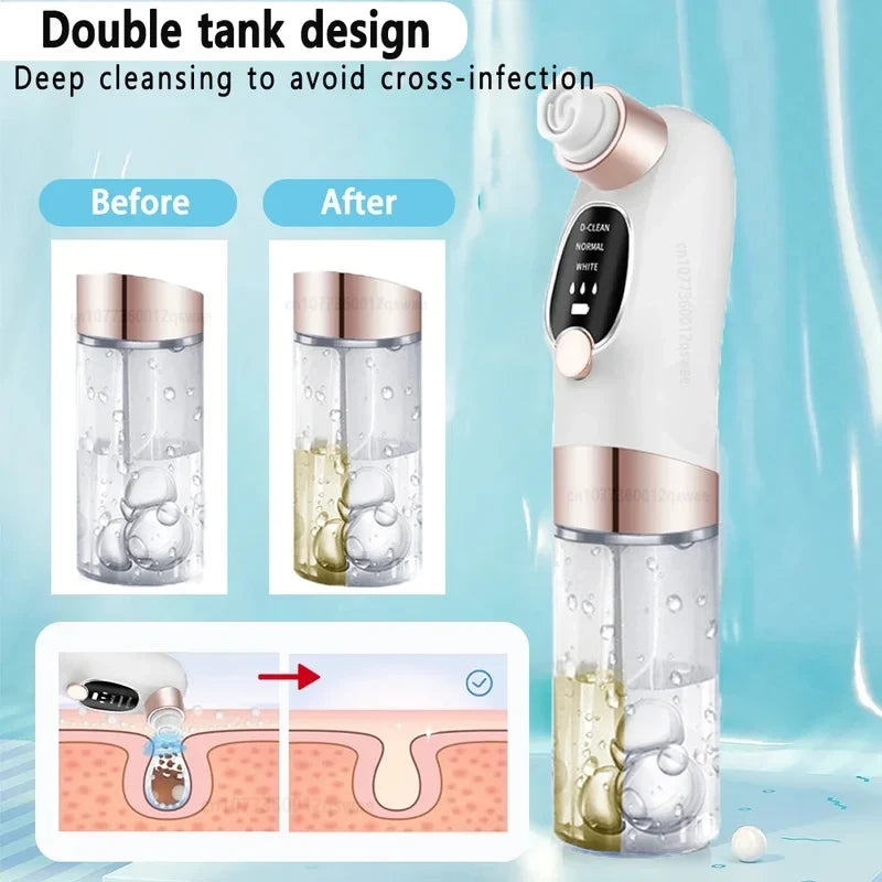 USB Rechargeable Blackhead Remover Pore Vacuum