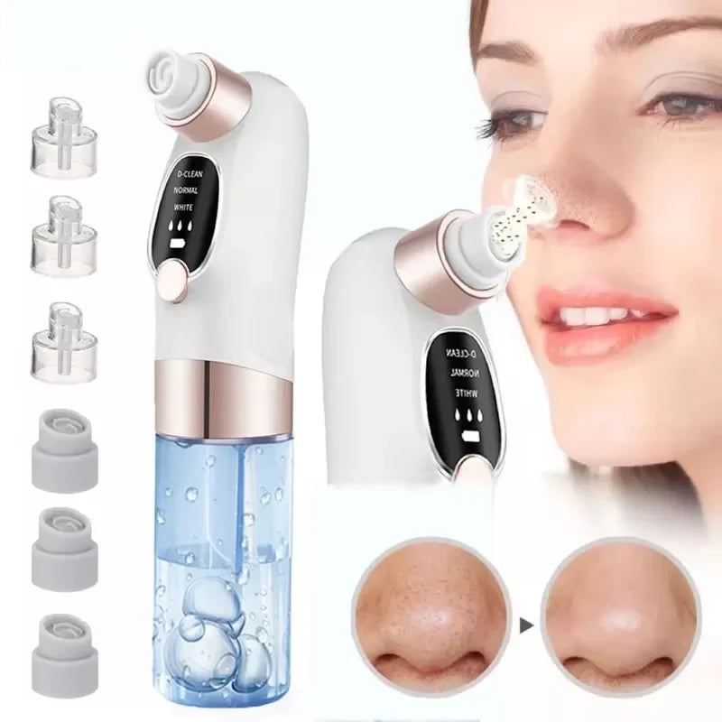 USB Rechargeable Blackhead Remover Pore Vacuum