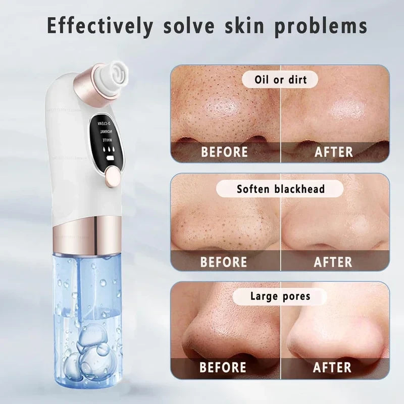 USB Rechargeable Blackhead Remover Pore Vacuum