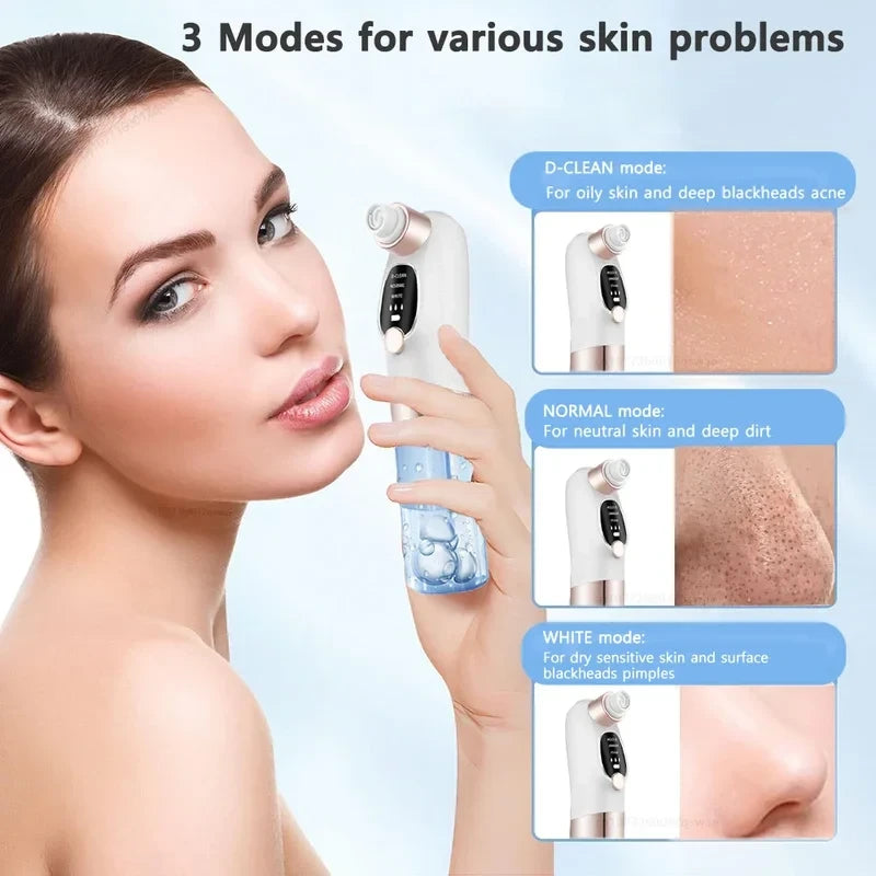 USB Rechargeable Blackhead Remover Pore Vacuum