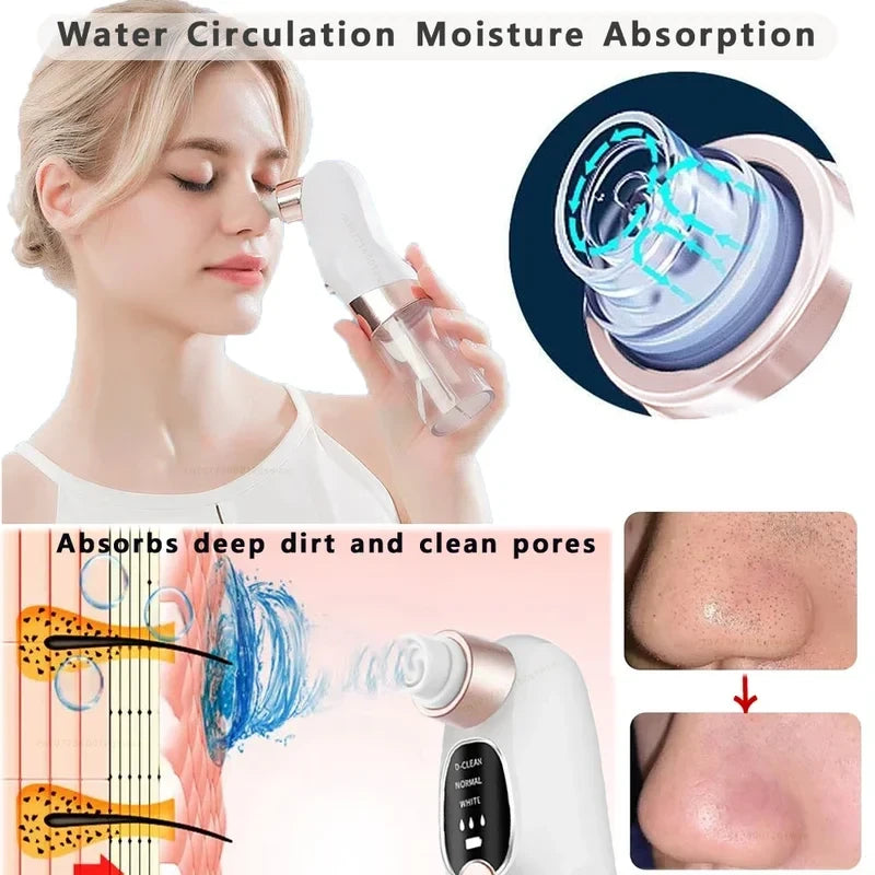 USB Rechargeable Blackhead Remover Pore Vacuum
